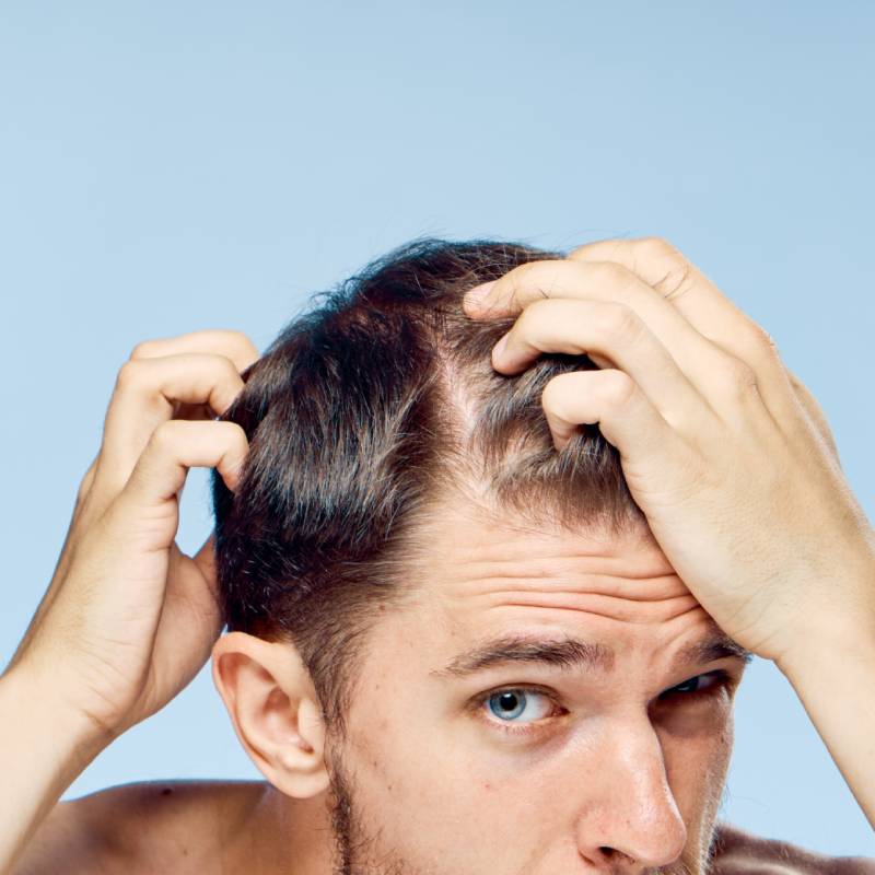 Reasons Your Hair Is Thinning